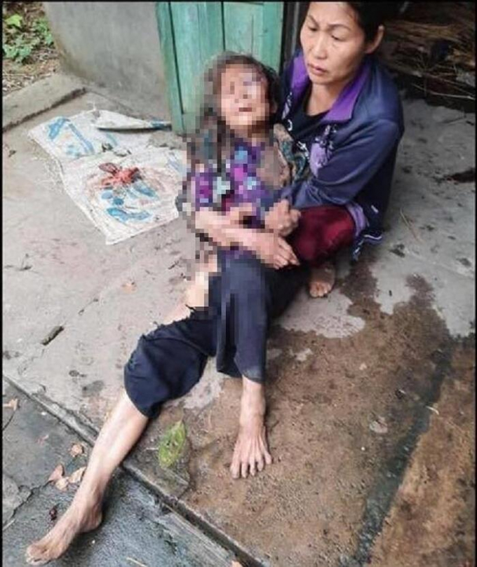 Thái Nguyên: Nam thanh niên thiêu sống cụ bà 90 tuổi để cướp 20 triệu đồng
