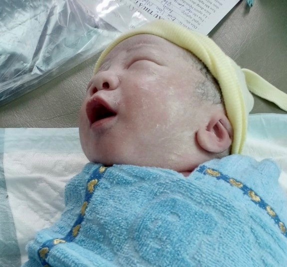 Bệnh viện Sản Nhi tỉnh Hậu Giang đã sinh mổ thành công cho một thai phụ nhiễm Covid-19