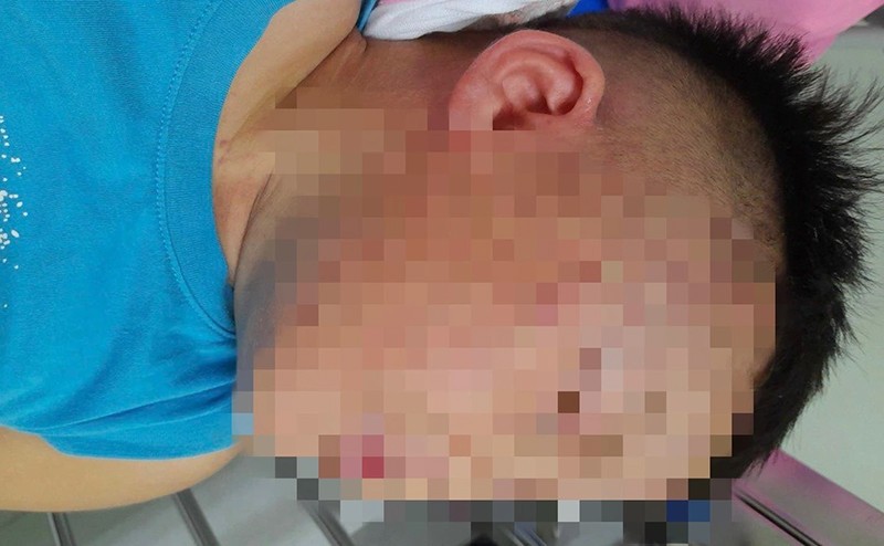 Hà Nam: Nghi án bé trai hơn 3 tuổi bị hàng xóm hành hung rồi nhốt vào tủ đông